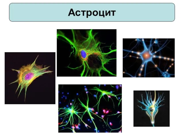 Астроцит