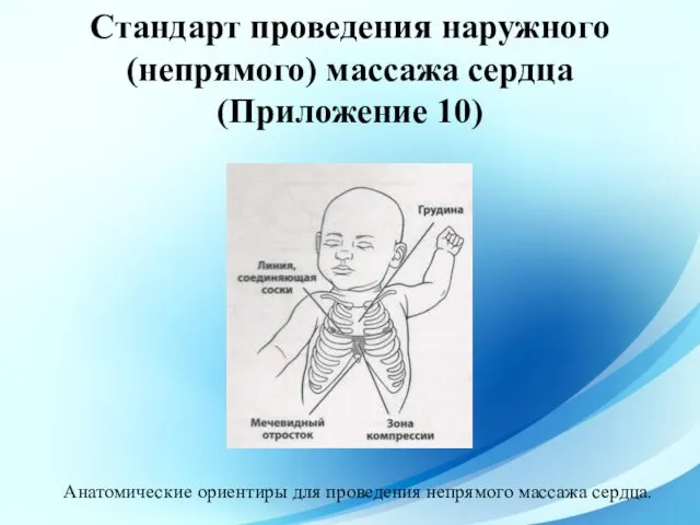 Стандарт проведения наружного (непрямого) массажа сердца (Приложение 10) Анатомические ориентиры для проведения непрямого массажа сердца.