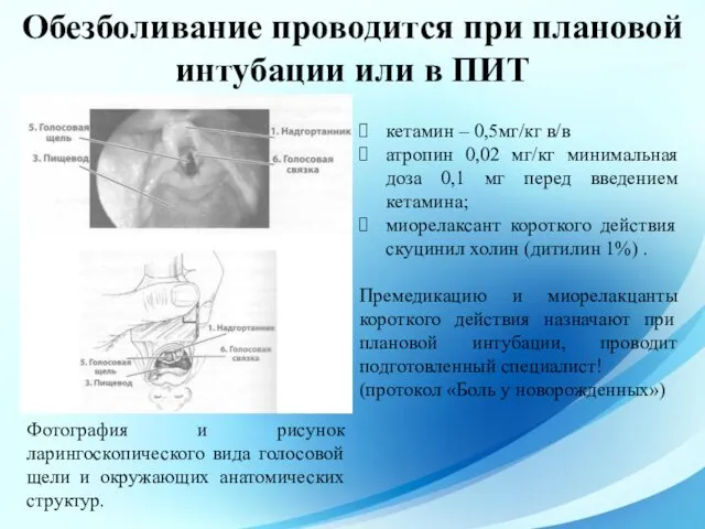 Обезболивание проводится при плановой интубации или в ПИТ Фотография и