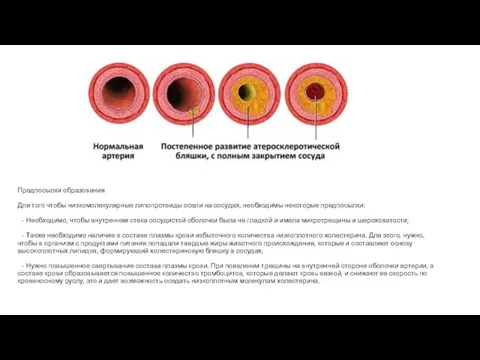 Предпосылки образования Для того чтобы низкомолекулярные липопротеиды осели на сосудах,