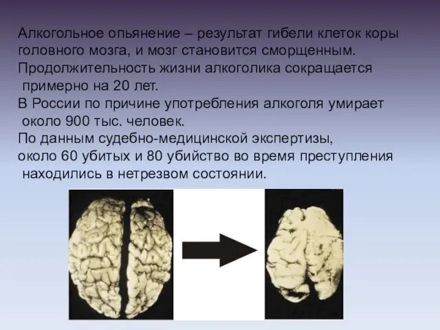 Алкогольное опьянение – результат гибели клеток коры головного мозга, и