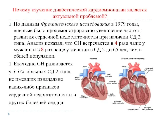 Почему изучение диабетической кардиомиопатии является актуальной проблемой? По данным Фремингемского исследования в 1979
