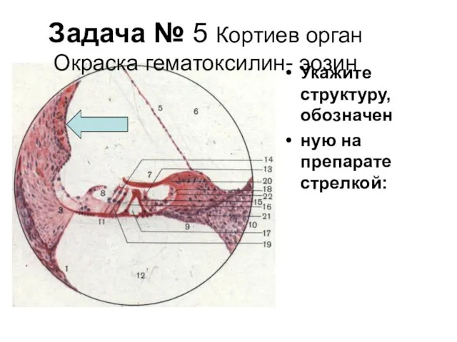 Задача № 5 Кортиев орган Окраска гематоксилин- эозин Укажите структуру, обозначен ную на препарате стрелкой: