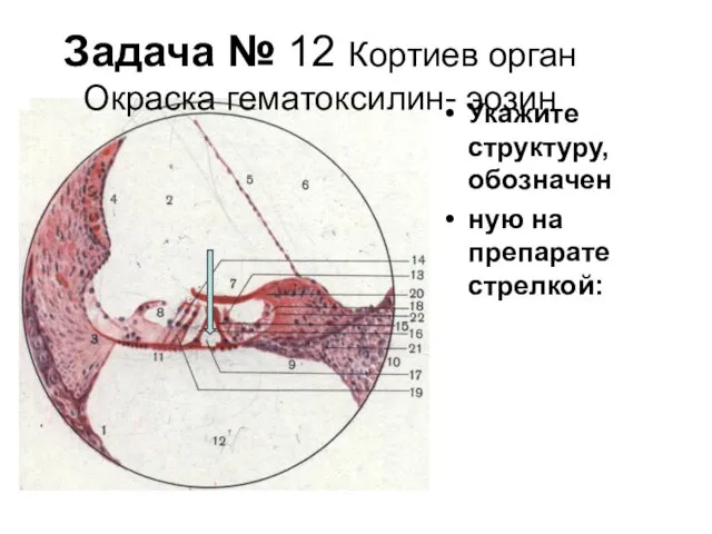 Задача № 12 Кортиев орган Окраска гематоксилин- эозин Укажите структуру, обозначен ную на препарате стрелкой: