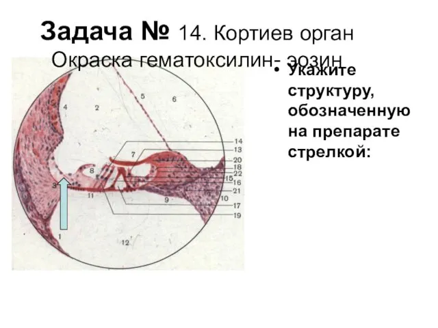 Задача № 14. Кортиев орган Окраска гематоксилин- эозин Укажите структуру, обозначенную на препарате стрелкой: