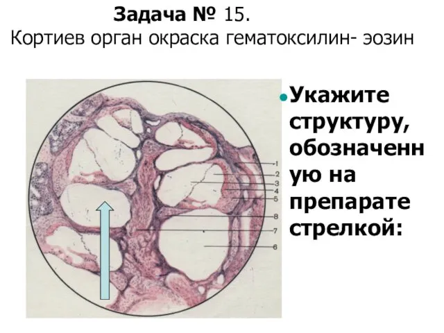 Укажите структуру, обозначенную на препарате стрелкой: Задача № 15. Кортиев орган окраска гематоксилин- эозин