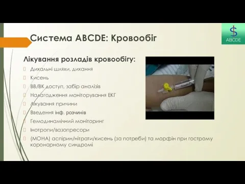 Система ABCDE: Кровообіг Лікування розладів кровообігу: Дихальні шляхи, дихання Кисень ВВ/ВК доступ, забір