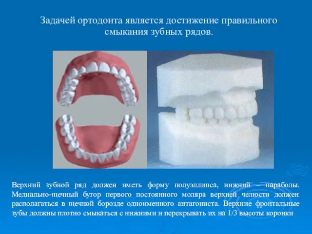 Задачей ортодонта является достижение правильного смыкания зубных рядов. Верхний зубной ряд должен иметь