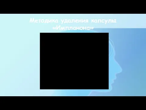 Методика удаления капсулы «Импланона»