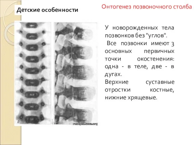 У новорожденных тела позвонков без "углов". Все позвонки имеют 3