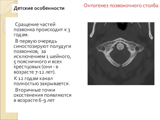 Сращение частей позвонка происходит к 3 годам. В первую очередь