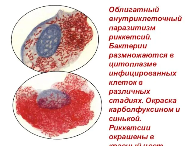 Облигатный внутриклеточный паразитизм риккетсий. Бактерии размножаются в цитоплазме инфицированных клеток