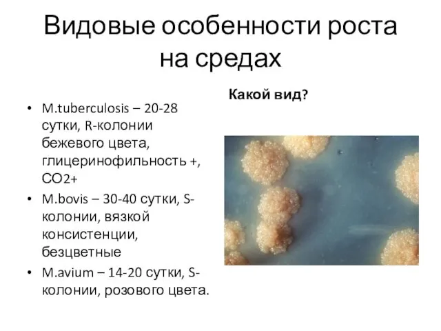 Видовые особенности роста на средах M.tuberculosis – 20-28 сутки, R-колонии