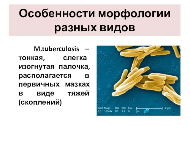 Особенности морфологии разных видов M.tuberculosis – тонкая, слегка изогнутая палочка,