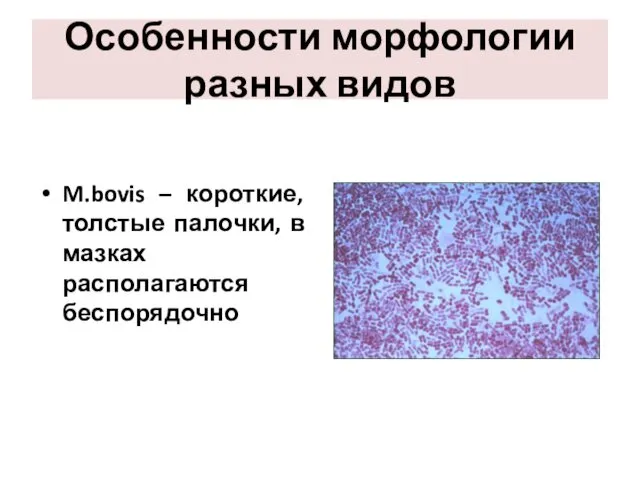 Особенности морфологии разных видов M.bovis – короткие, толстые палочки, в мазках располагаются беспорядочно