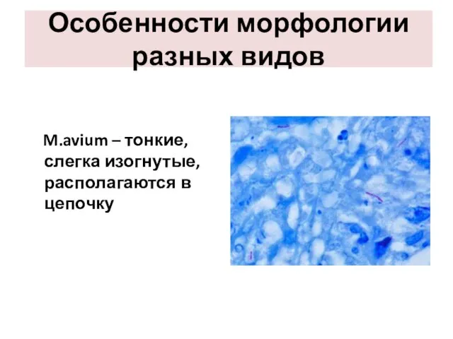 Особенности морфологии разных видов M.avium – тонкие, слегка изогнутые, располагаются в цепочку