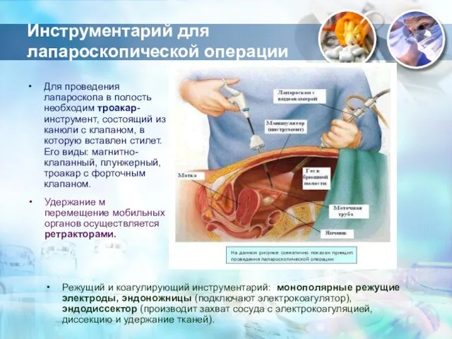 Инструментарий для лапароскопической операции Для проведения лапароскопа в полость необходим