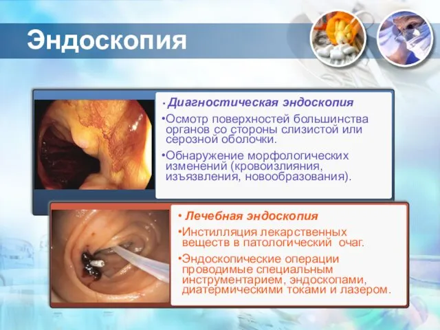 Эндоскопия Диагностическая эндоскопия Осмотр поверхностей большинства органов со стороны слизистой