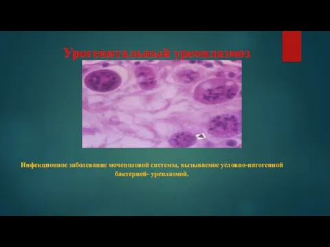 Урогенитальный уреоплазмоз Инфекционное заболевание мочеполовой системы, вызываемое условно-патогенной бактерией- уреплазмой.