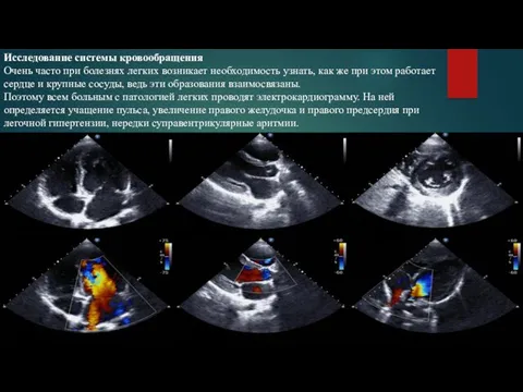 Исследование системы кровообращения Очень часто при болезнях легких возникает необходимость