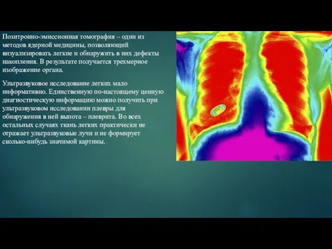 Позитронно-эмиссионная томография – один из методов ядерной медицины, позволяющий визуализировать