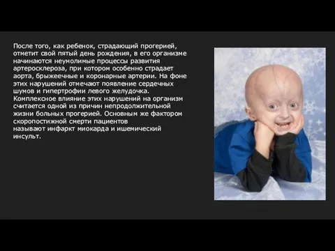 После того, как ребенок, страдающий прогерией, отметит свой пятый день