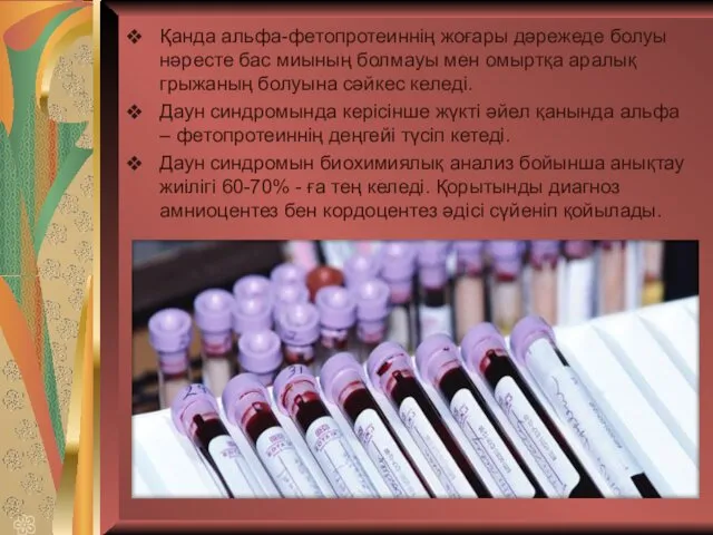 Қанда альфа-фетопротеиннің жоғары дәрежеде болуы нәресте бас миының болмауы мен