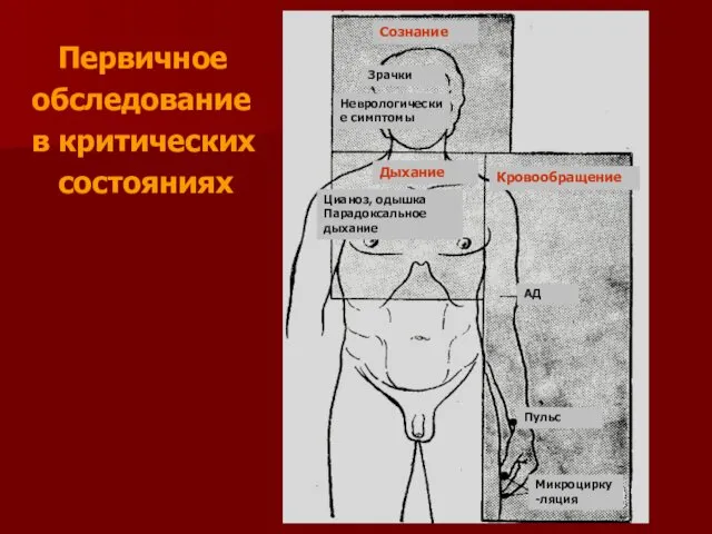 Первичное обследование в критических состояниях Сознание Зрачки Неврологические симптомы Кровообращение