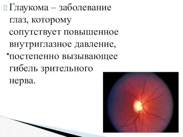 Глаукома – заболевание глаз, которому сопутствует повышенное внутриглазное давление, постепенно вызывающее гибель зрительного нерва. .