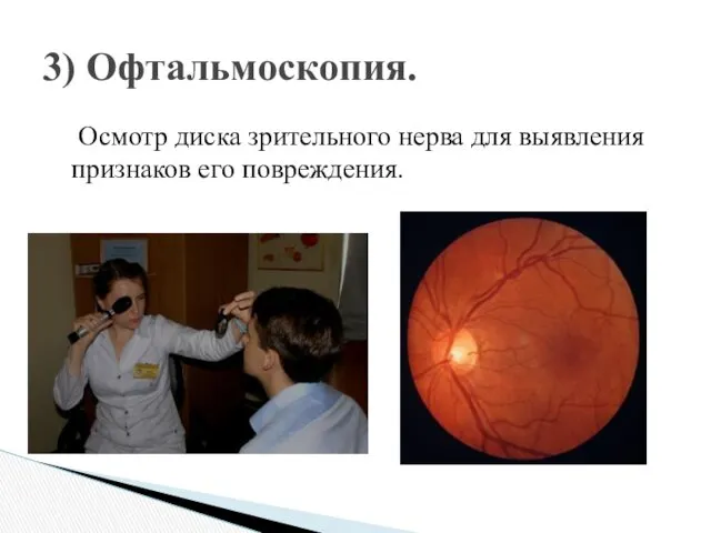 Осмотр диска зрительного нерва для выявления признаков его повреждения. 3) Офтальмоскопия.