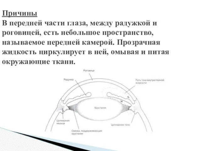 Причины В передней части глаза, между радужкой и роговицей, есть