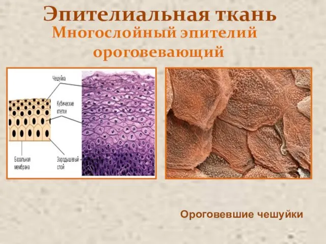 Эпителиальная ткань Многослойный эпителий ороговевающий Ороговевшие чешуйки