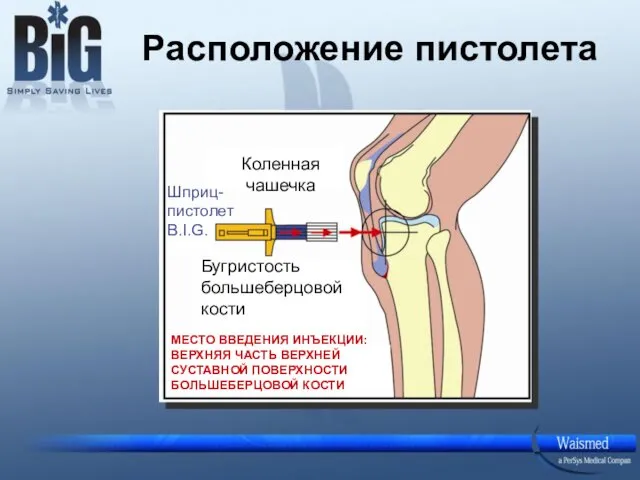 Расположение пистолета