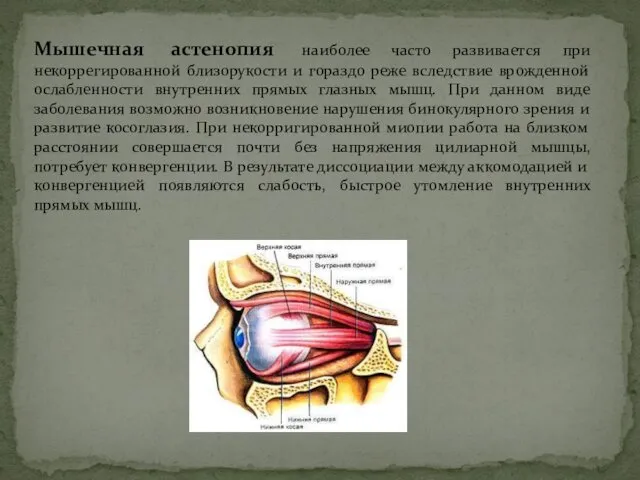 Мышечная астенопия наиболее часто развивается при некоррегированной близорукости и гораздо