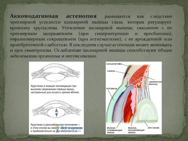 Аккомодативная астенопия развивается как следствие чрезмерной усталости цилиарной мышцы глаза,