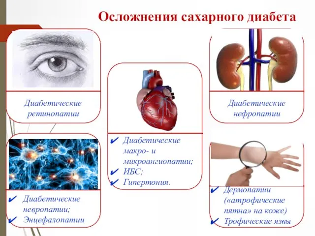 Осложнения сахарного диабета Диабетические нефропатии Диабетические макро- и микроангиопатии; ИБС;