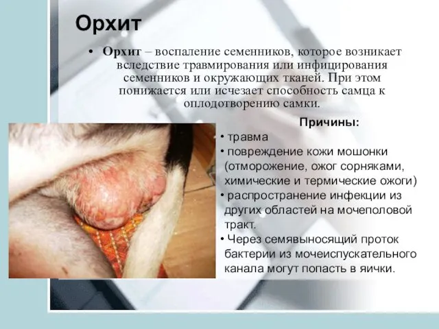 Орхит Орхит – воспаление семенников, которое возникает вследствие травмирования или