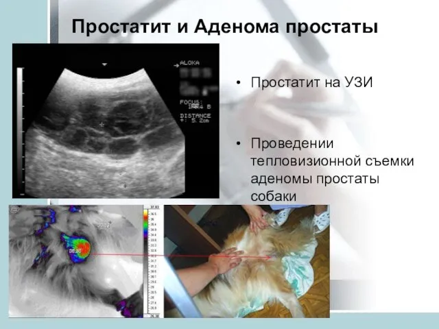 Простатит и Аденома простаты Простатит на УЗИ Проведении тепловизионной съемки аденомы простаты собаки