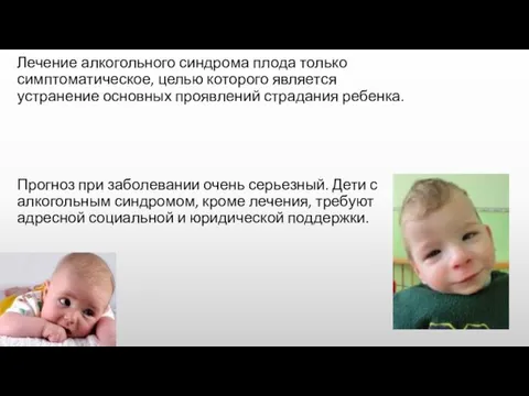 Лечение алкогольного синдрома плода только симптоматическое, целью которого является устранение