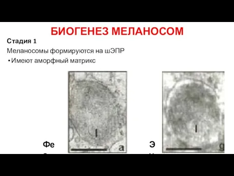 БИОГЕНЕЗ МЕЛАНОСОМ Стадия 1 Меланосомы формируются на шЭПР Имеют аморфный матрикс Фео Эу