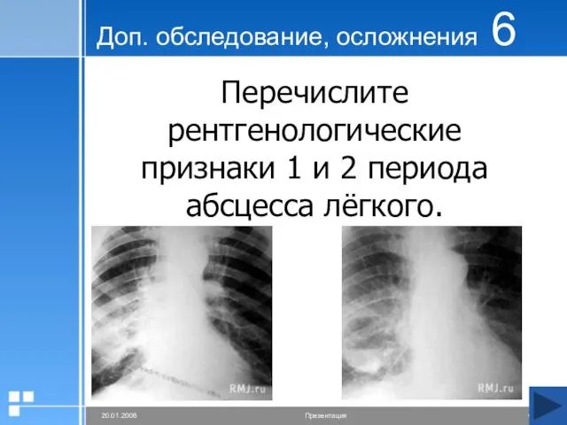 Доп. обследование, осложнения 6 Перечислите рентгенологические признаки 1 и 2 периода абсцесса лёгкого.