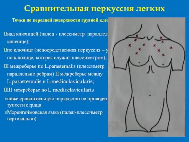 Сравнительная перкуссия легких Точки по передней поверхности грудной клетки :