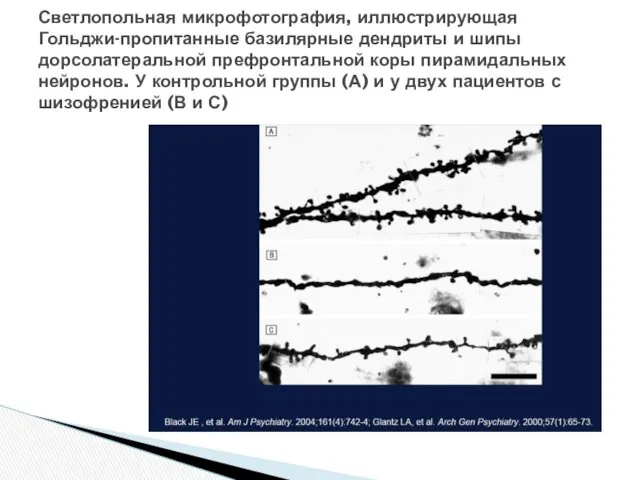 Светлопольная микрофотография, иллюстрирующая Гольджи-пропитанные базилярные дендриты и шипы дорсолатеральной префронтальной