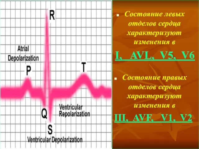 Состояние левых отделов сердца характеризуют изменения в I, AVL, V5,