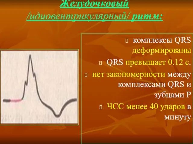 Желудочковый /идиовентрикулярный/ ритм: комплексы QRS деформированы QRS превышает 0.12 c.