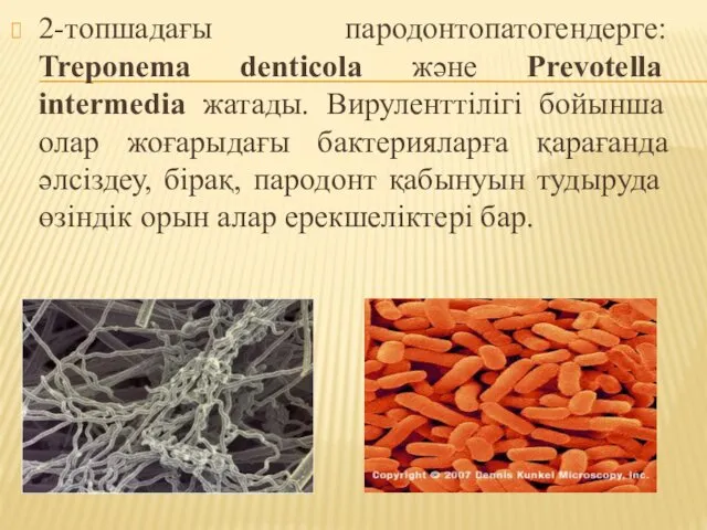 2-топшадағы пародонтопатогендерге: Treponema denticola және Prevotella intermedia жатады. Вируленттілігі бойынша олар жоғарыдағы бактерияларға