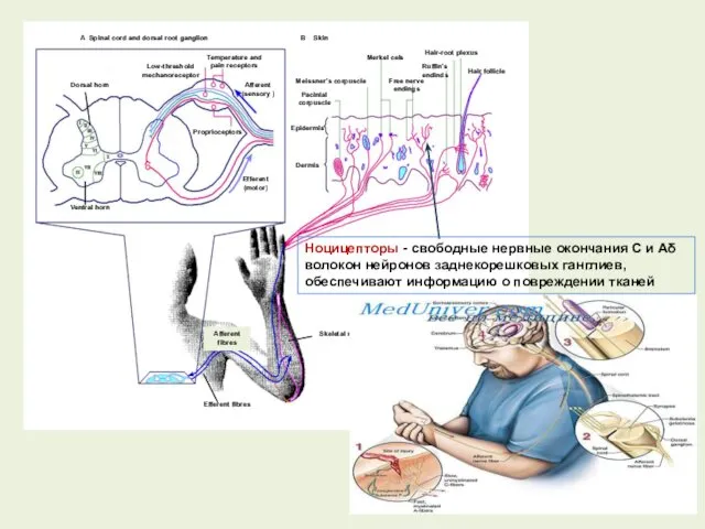 Ноцицепторы - свободные нервные окончания С и Аδ волокон нейронов заднекорешковых ганглиев, обеспечивают