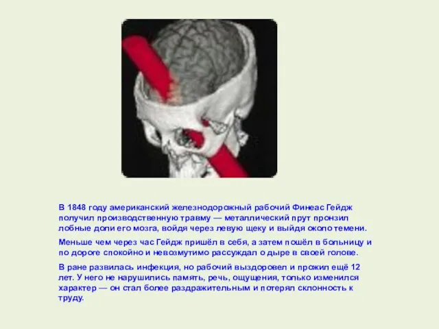 В 1848 году американский железнодорожный рабочий Финеас Гейдж получил производственную травму — металлический