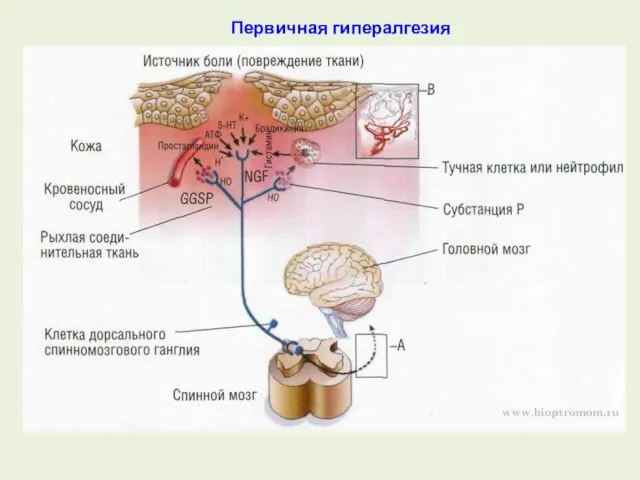 Первичная гипералгезия