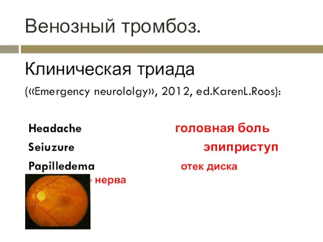 Венозный тромбоз. Клиническая триада («Emergency neurololgy», 2012, ed.KarenL.Roos): Headache головная